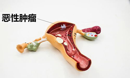 中宁汽车除甲醛价格多少