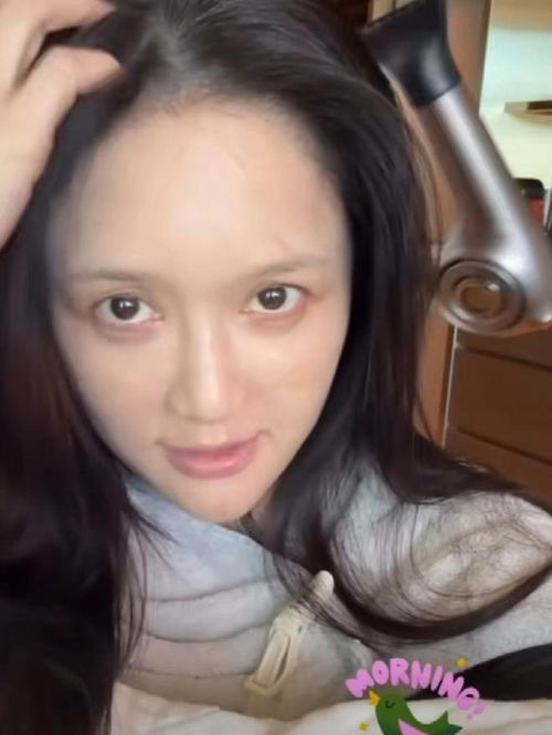 陈乔恩\满脸扎针\晒保养方法引热议(陈乔恩满脸扎针晒保养方法引热议)