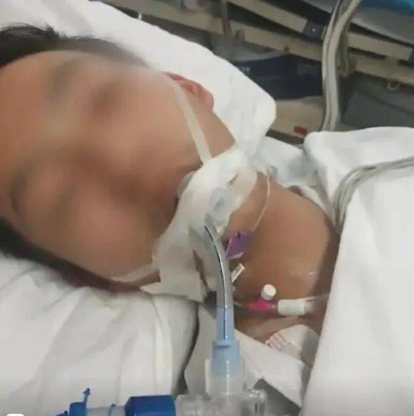 10岁男孩打《拳皇》致掌骨骨折