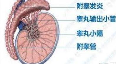 中山男子取结石冲出肝吸虫